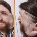 Udruženje Pomozi.ba poziva na pomoć Jasenku Ramiću (29)