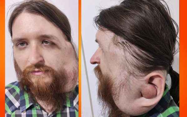 Udruženje Pomozi.ba poziva na pomoć Jasenku Ramiću (29)